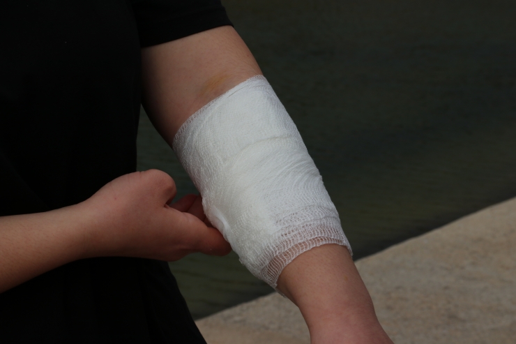 Şanlıurfa'da sokak köpeklerinin saldırısına uğrayan üniversite öğrencisi kız yaralandı